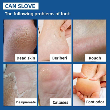 Rozino Tea Tree Oil Foot & Damage Skin Repair Cream | Vitamin E, Aloe Vera & Peppermint | Repairs Cracked Heels, Dry Feet & Rough Skin