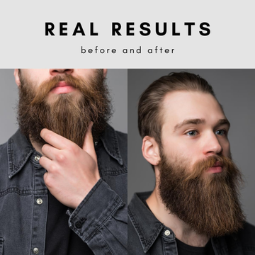 SEVICH Beard Balm – Nourish, Shape & Soften – With Shea Butter & Biotin – Controls Frizz & Flyaways – Soothes Sensitive Skin – All-Natural, Cruelty-Free, Paraben-Free