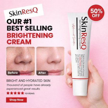 Skin ResQ Brightening Cream | #1 Bestselling Formula with Alpha Arbutin, Niacinamide & Vitamin C | Fades Hyperpigmentation, Dark Spots & Acne Marks
