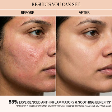 Skin ResQ Brightening Cream | #1 Bestselling Formula with Alpha Arbutin, Niacinamide & Vitamin C | Fades Hyperpigmentation, Dark Spots & Acne Marks