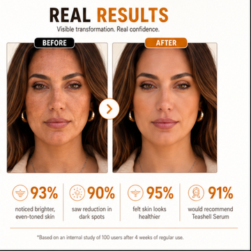 Teashell Niacinamide Brightening Serum – Targets Melasma, Dark Spots & Freckles – Brightens & Evens Skin Tone, Improves Texture & Radiance – For All Skin Types