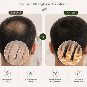 Tgideas Rosemary Amino Acid Shampoo – Repair, Nourish & Strengthen – Reduces Hair Fall, Deep Scalp Nourishment – With Rosemary Extract & Amino Acids – Smooth & Silky Hair – Sulfate Free